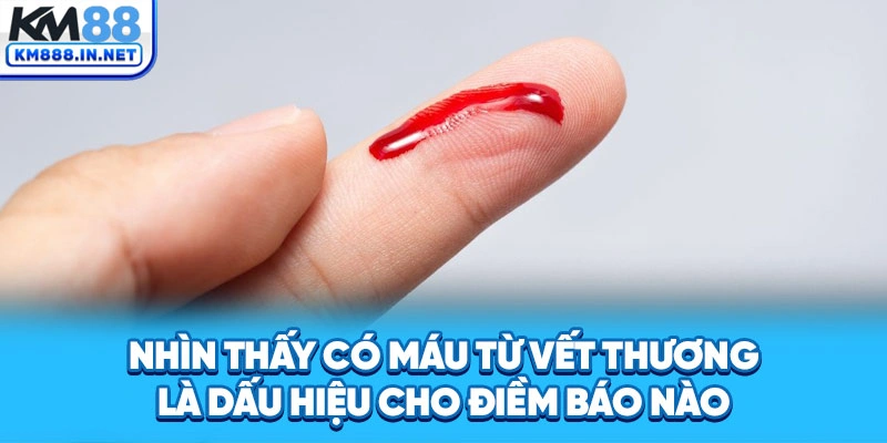 Nhìn thấy có máu từ vết thương là dấu hiệu cho điềm báo nào